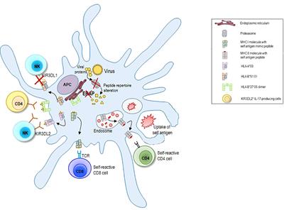 Editorial: Targeting antigen processing and presentation in autoimmune and autoinflammatory disorders